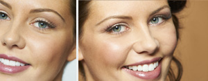 Snippeteyelashes4